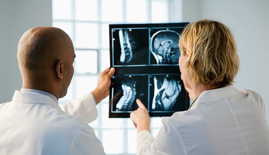 Diagnose der zervikalen Osteochondrose durch Bildgebung