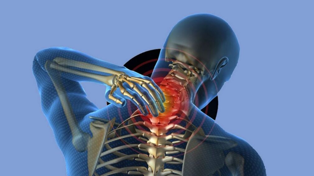 Osteochondrose der Gebärmutterhalsregion