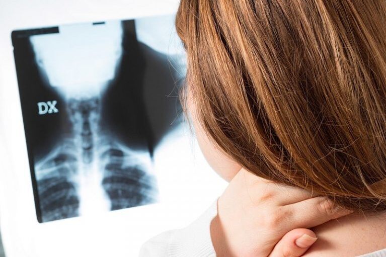 X -Ray der Gebärmutterhalsregion