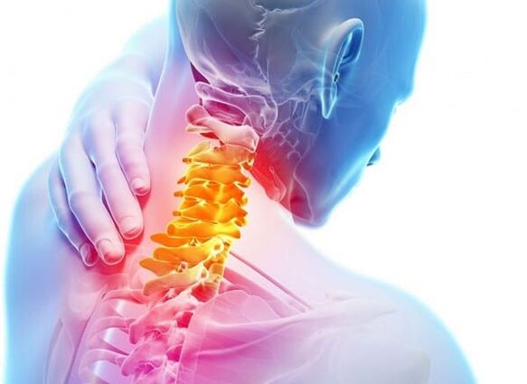 Osteochondrose der Halsspalte
