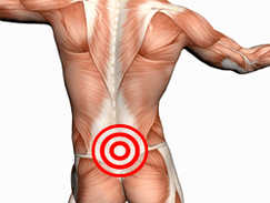 Symptome und Behandlung der lumbalen Osteochondrose