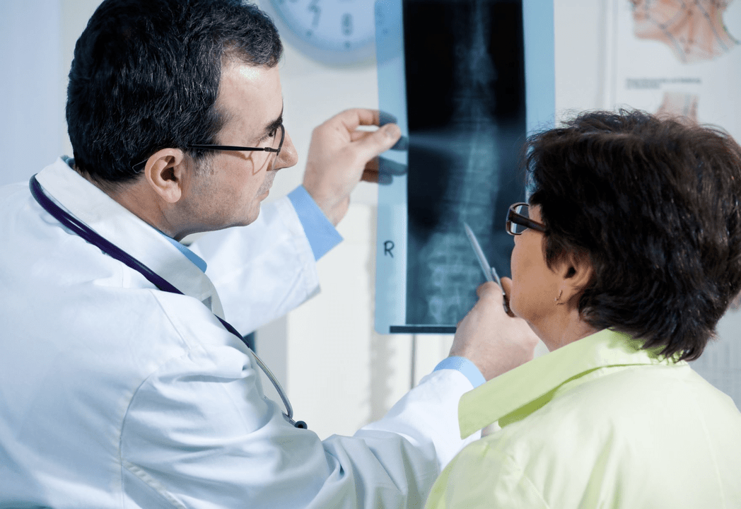 Ein Neurologe diagnostiziert Osteochondrose anhand einer Röntgenaufnahme der Wirbelsäule.