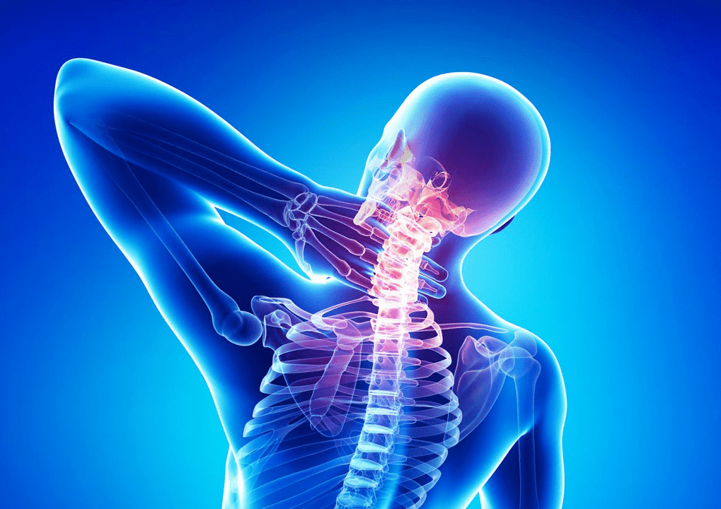 Osteochondrose der Wirbelsäule