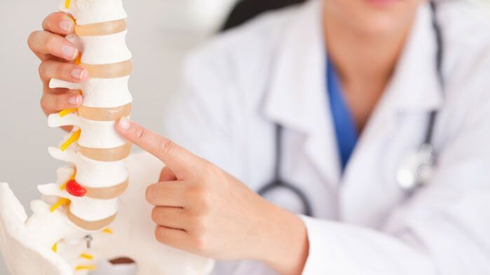 Erklärung der lumbalen Osteochondrose am Wirbelsäulenmodell.